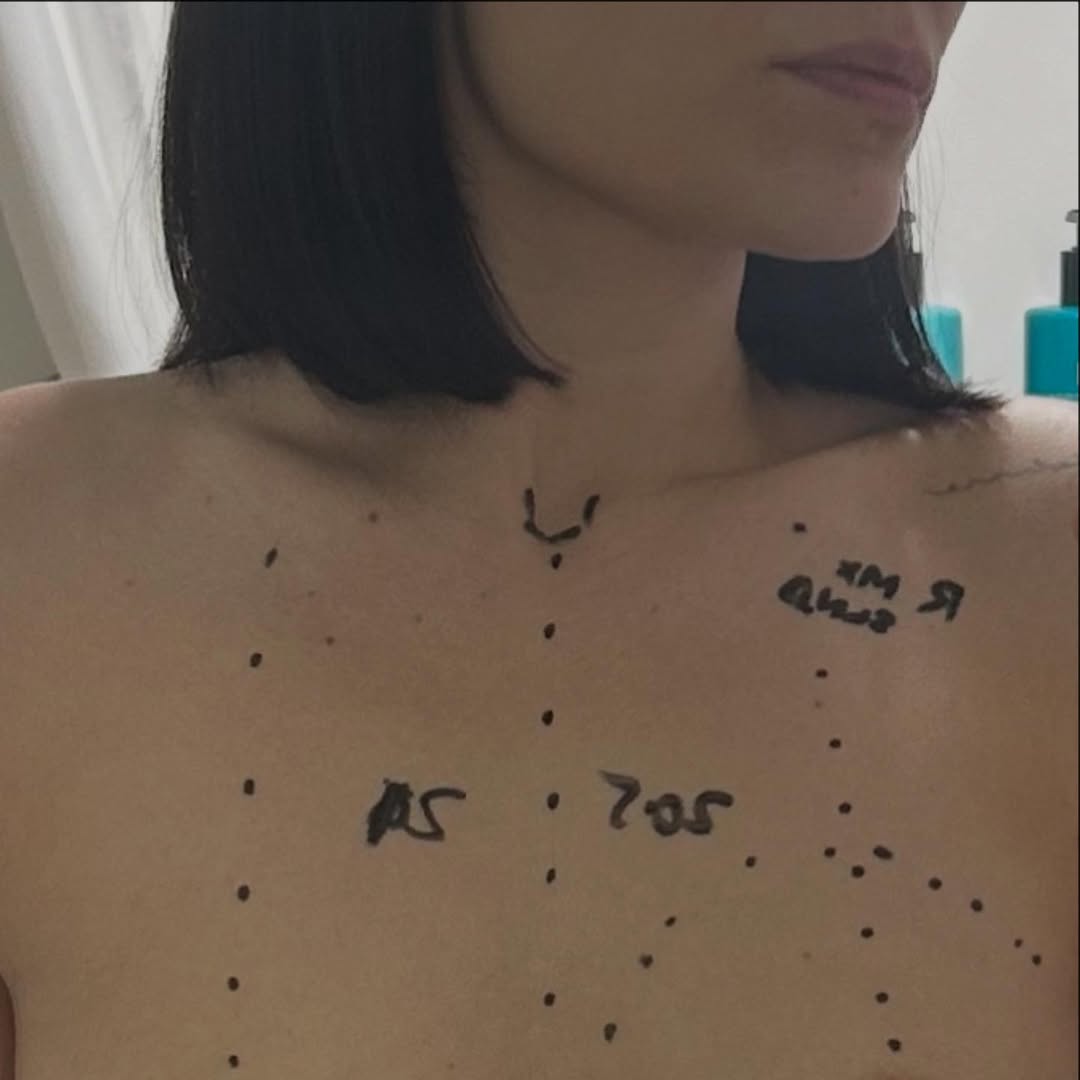 Η Jessie J υποβλήθηκε σε χειρουργική επέμβαση για καρκίνο του μαστού.