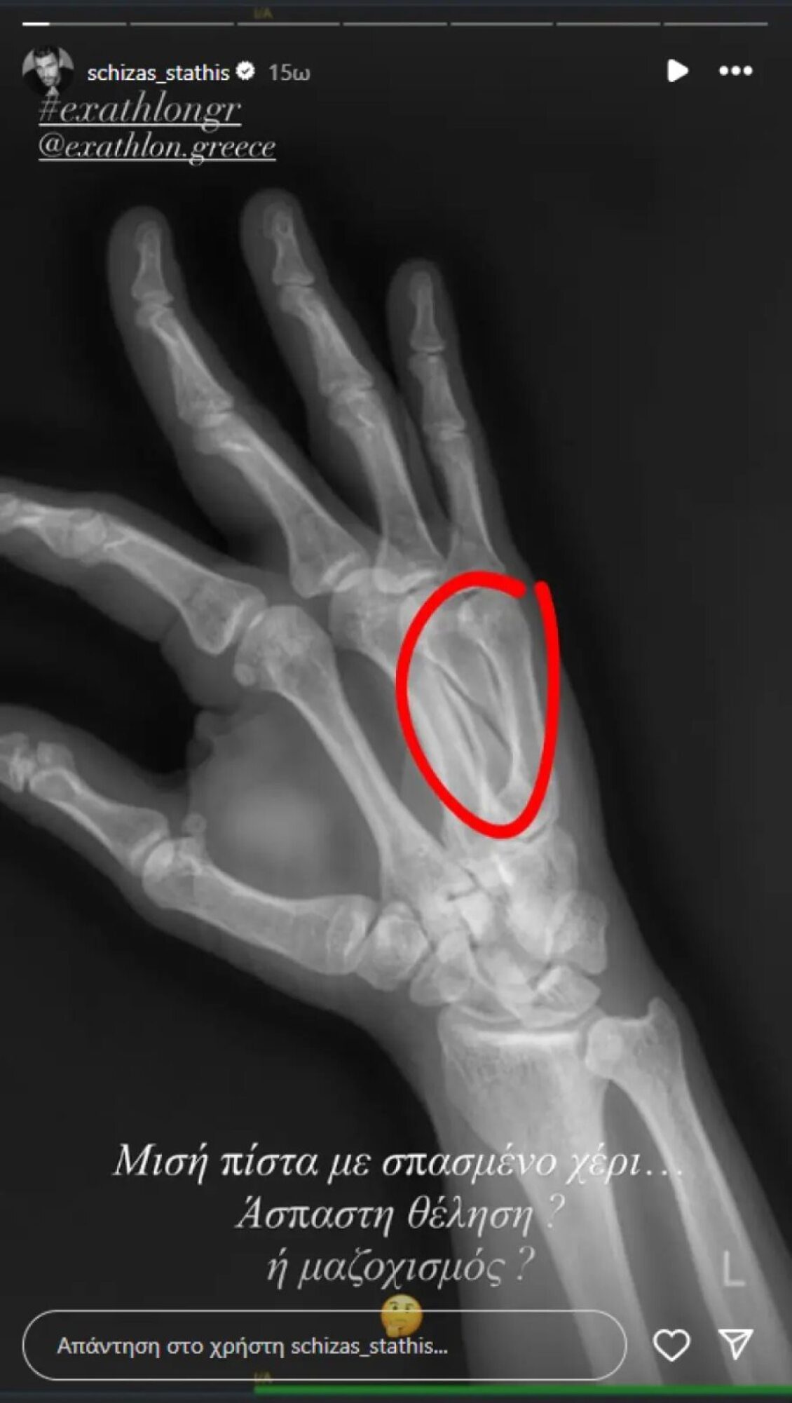 Στάθης Σχίζας: «Άσπαστη θέληση ή μαζοχισμός;»