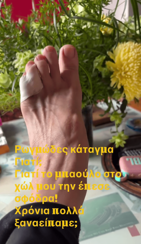 Ένα απρόοπτο ατύχημα μέσα στο σπίτι της είχε η Κωνσταντίνα Μιχαήλ, με την αγαπημένη ηθοποιό να ενημερώνει η ίδια τους διαδικτυακούς της φίλους μέσα από ανάρτηση στο Instagram.